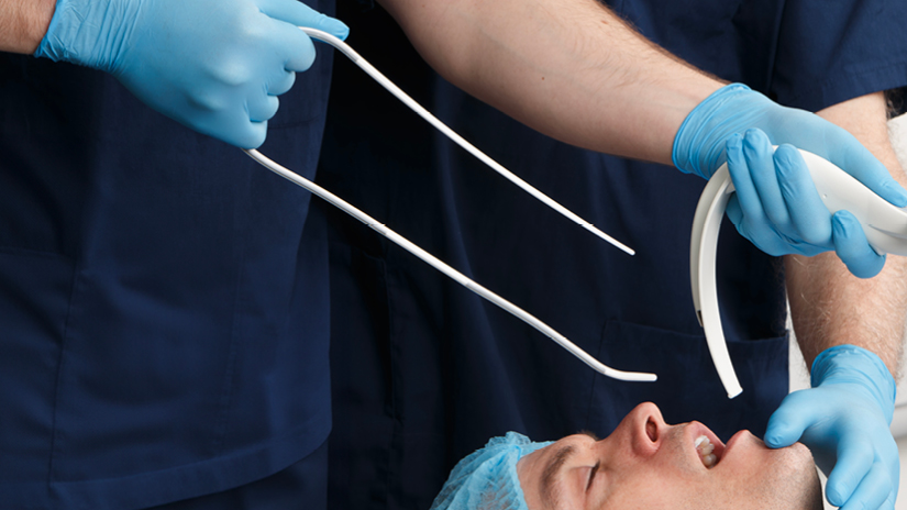 Vi presentiamo il dispositivo USB™ - Universal Stylet Bougie